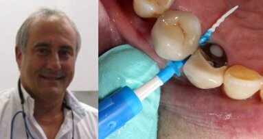 Un original dispositivo para la limpieza interdental