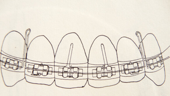 A review of the original Combination Technique and philosophy