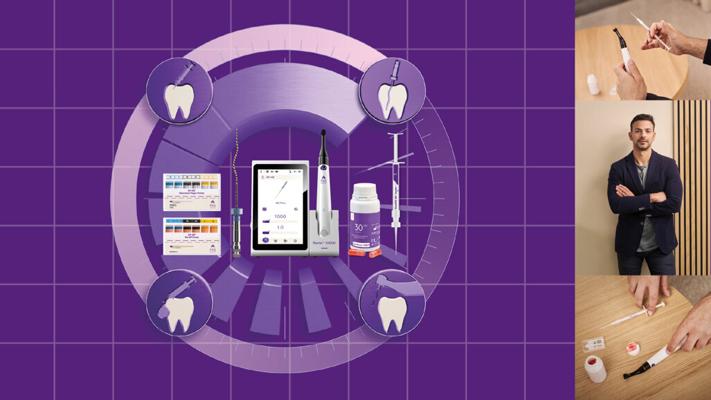 FKG Dentaire launches 4D Workflow for streamlined endodontics