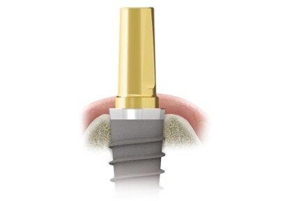 PERIOSAFE & IMPLANTSAFE