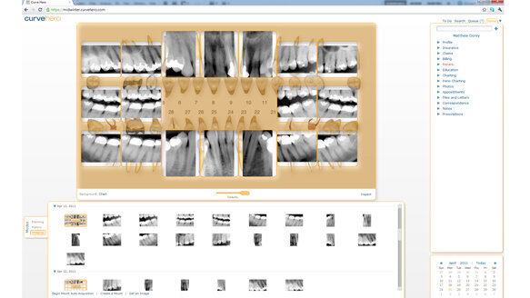 Curve Dental announces field testing of its Web-based Dental Imaging Software