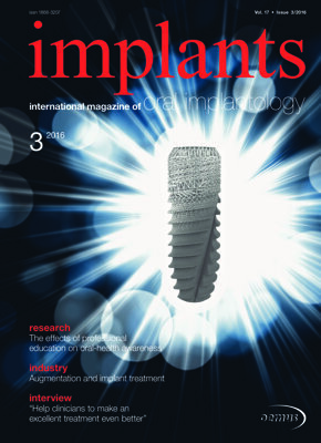 implants international No. 3, 2016 implants international No. 3, 2016