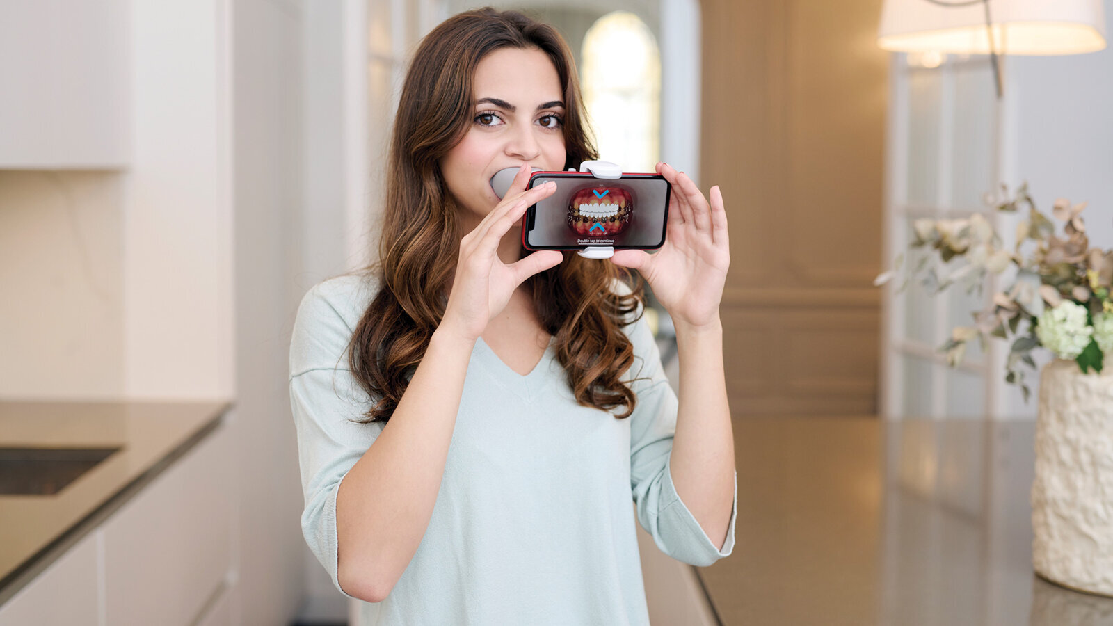 DentalMonitoring launches ScanBox Pro