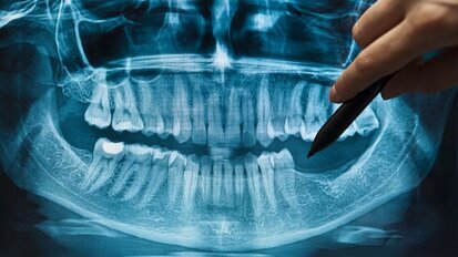 Registratie van stralingsbron vanaf nu digitaal