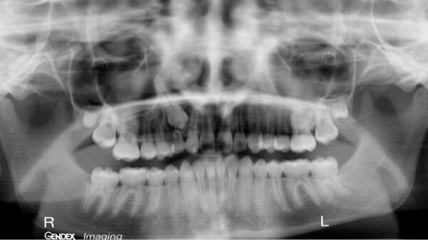 Fyzikální cévní terapie ve stomatochirurgické ordinaci