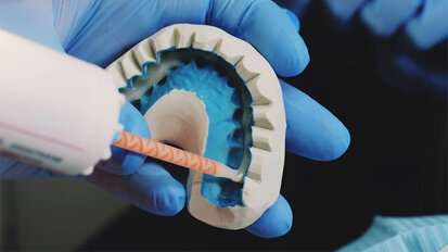 New glue could be dentistry game changer New glue could be dentistry game changer
