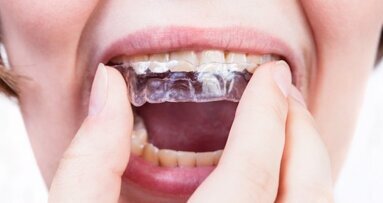 Três perguntas para Keith Batcheller, ClearCorrect