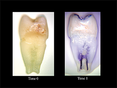 Slika 2a: Sleiman-Iandolo test. Sveže ekstrahovani premolar ofarban metilnskom plavom bojom u centrifugi. Uočljiva je duboka penetracija boje, naročito u kruničnim delovima. Vreme 0 Vreme 1