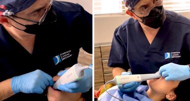 Lo que debes saber sobre los escáneres intraorales (2)