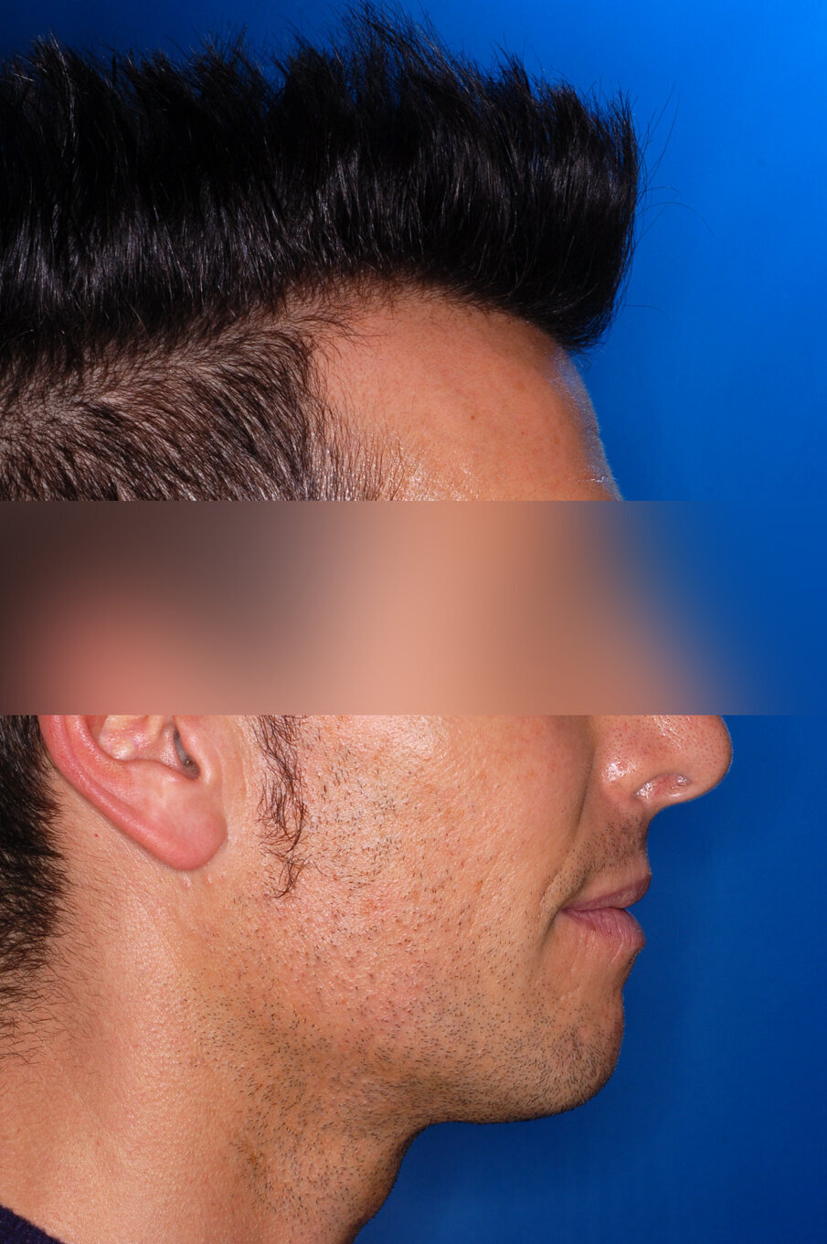 Figg. 1-8_Fotografie facciali e intraorali pre-trattamento.