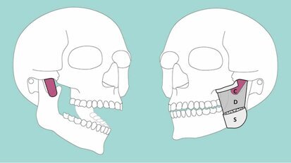 Neue Muskelschicht am Kiefer entdeckt Neue Muskelschicht am Kiefer entdeckt
