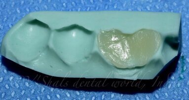 Custom shield Technique