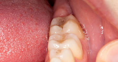 Test sline bi lahko razkril resne bolezni