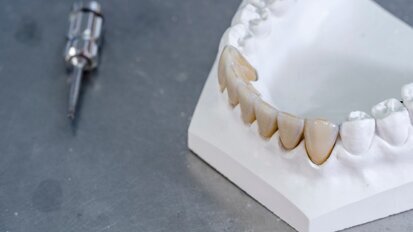 Monolithique zircone : la prothèse de précision pour vos patients