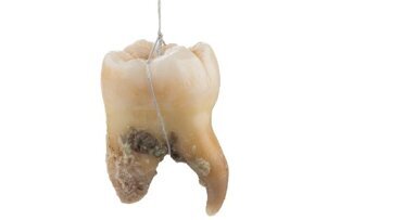 Prävention ist die Zukunft: Experten stellen innovatives Erfolgskonzept vor