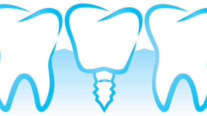 International Society of Metal-Free Implantology gegründet International Society of Metal-Free Implantology gegründet