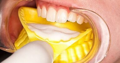 Profesjonalna i domowa profilaktyka u pacjentów z uzupełnieniami na wszczepach zębowych