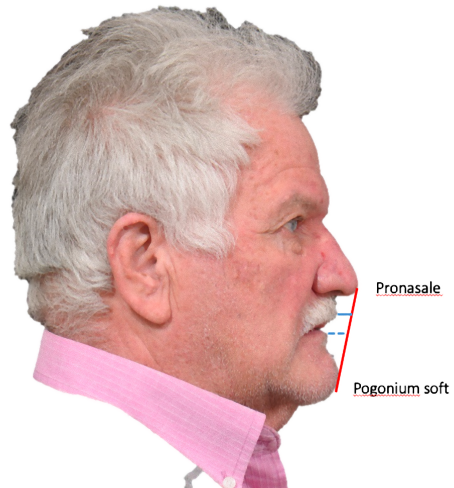 Fig. 4_Piano estetico di Ricketts.