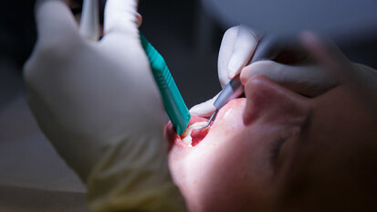 Interview: This work helps us understand acute periodontal pathogens Interview: This work helps us understand acute periodontal pathogens