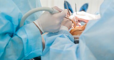 3D-printed screw-retained single crown: A chairside single-visit workflow