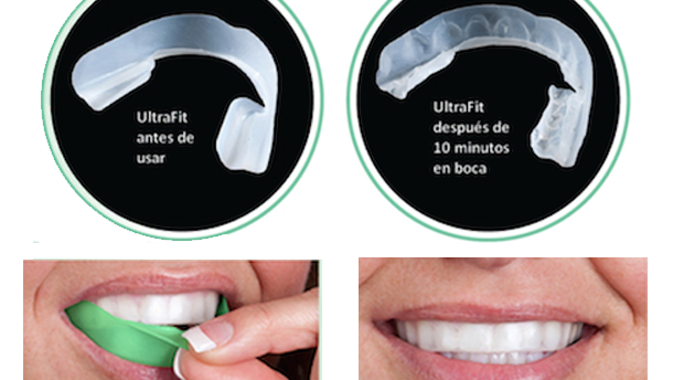 Opalescence Go, la evolución del blanqueamiento