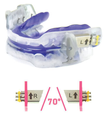 Aparát proti chrápání