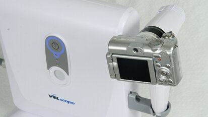 World Health Organization honors oral cancer screening device