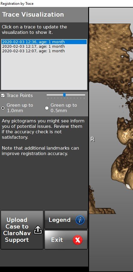 Figg. 14a, 14b - La registrazione di tutti i dati del nostro intervento: a) I video con audio ripresi durante l’attività del sistema (incluse le fasi di pianificazione e consultazione); b) I dati delle trace registrations della chirurgia in questione.