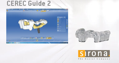 Interventi di implantologia rapidi e semplici con CEREC Guide 2