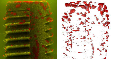 Laserverfahren ermöglicht Bakterien-Scan auf Implantaten