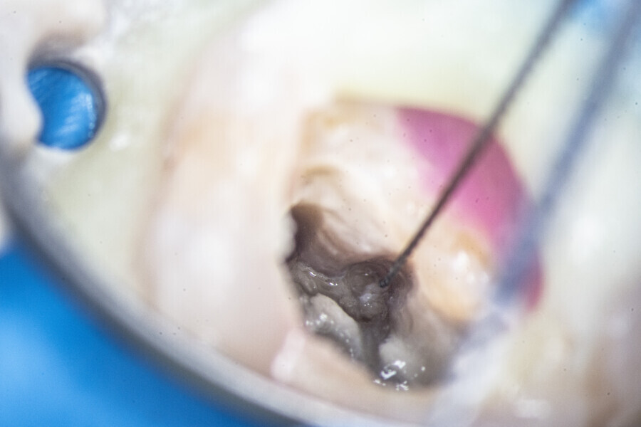 Fig. 57: Scouting the MB2 canal.