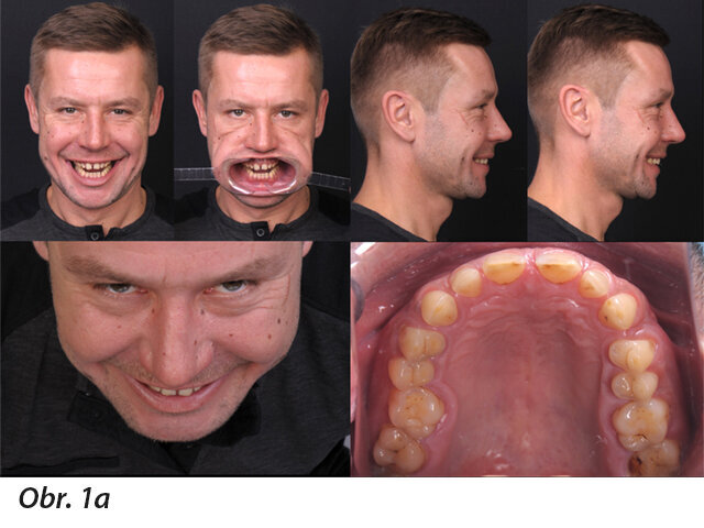 Obr. 1a: Základní sada fotografií pro DSD plánování může být zhotovena pomocí digitálního fotoaparátu nebo jako obr. 1b