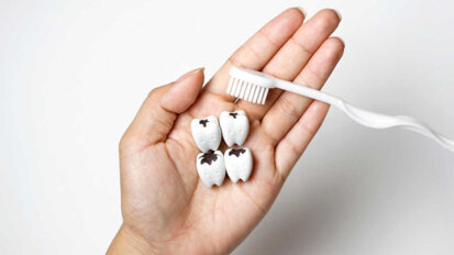 De nouvelles obturations antibactériennes contre les caries dentaires récurrentes