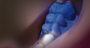 La CFAO florissante au plus grand salon mondial d'art dentaire