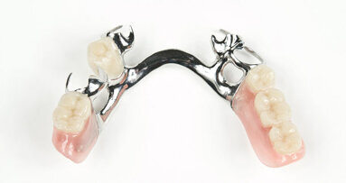 False teeth stuck in throat for nine weeks