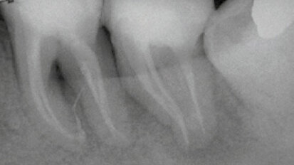 Photon Induced Photoacoustic Streaming