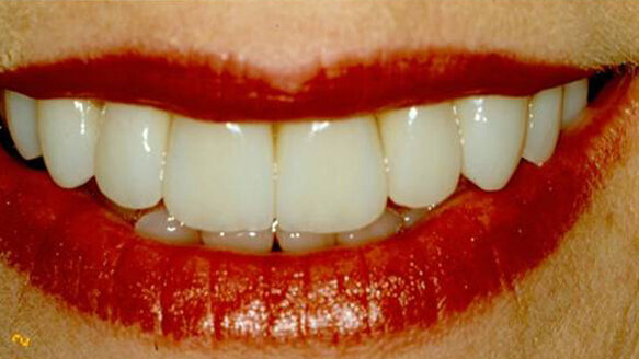 Getting acquainted with Insta-Ortho