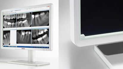 Eonis Dental-Displays: hohe Bildqualität für schnelle, akkurate Diagnosen und Prüfung zahnmedizinischer Bilder Eonis Dental-Displays: hohe Bildqualität für schnelle, akkurate Diagnosen und Prüfung zahnmedizinischer Bilder