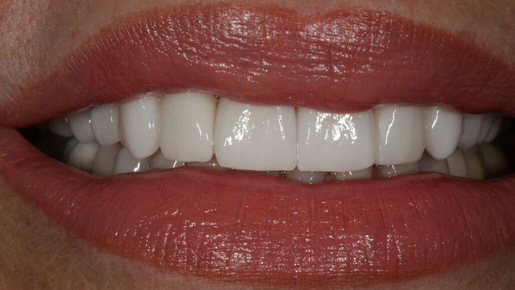 Intégration de la conception numérique du sourire