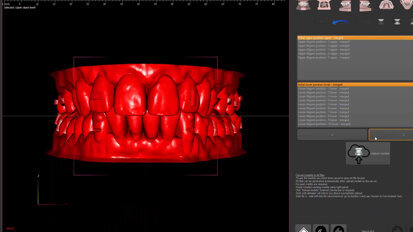 Polorto – DTS – Aligners Planner