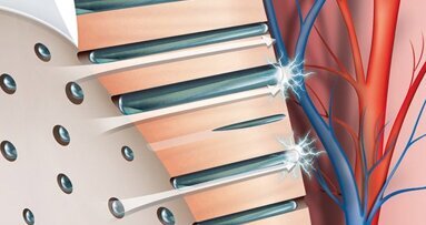 Ipersensibilità dentinale semplificata