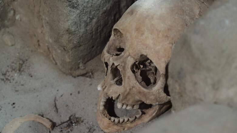 Zivilisationskrankheit Karies gab es bereits vor 12,5 Mio. Jahren