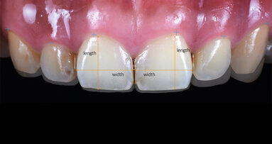 Short cut in the digital fast track