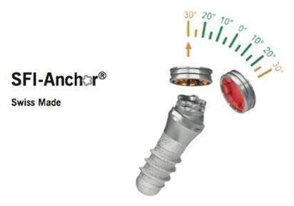 SFI-Anchor®