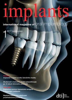 implants Czech Republic No. 1, 2017