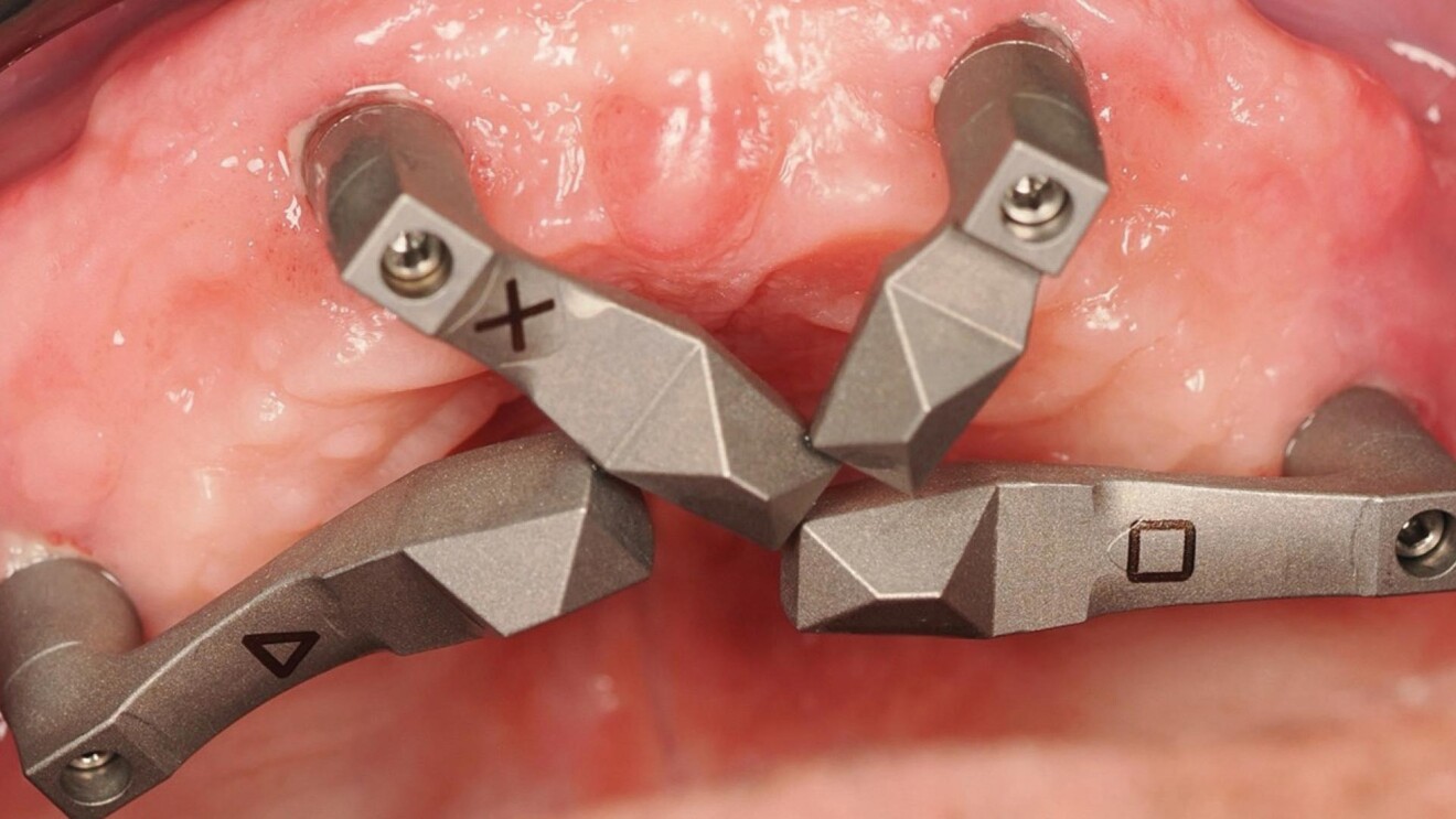Fig. 2 - Ecco la convergenza , ecco la Scan-Area ristretta, ecco il concetto alla base di ScanLogiq.
