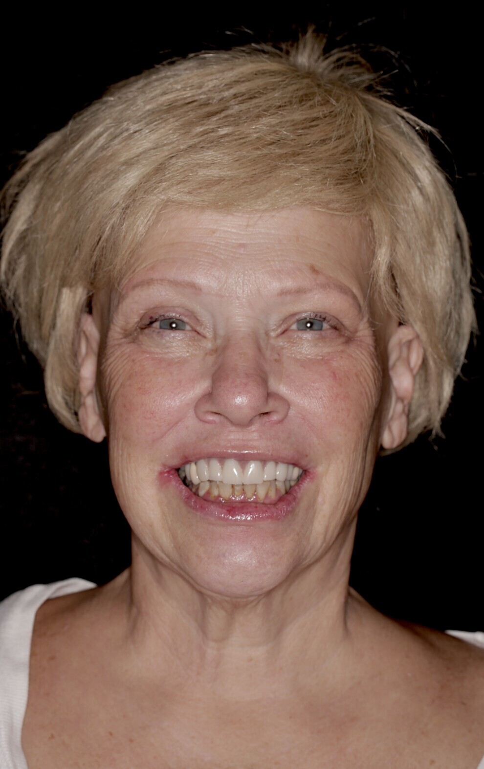 Fig. 1: Full-face view of the initial situation.