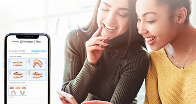 Align Technology objavio softver iTero Workflow 2.0