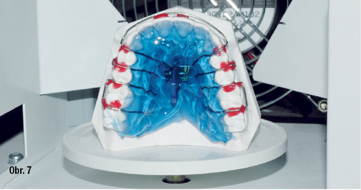 Postup práce s Orthocryl LC