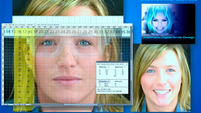 Aesthetic Digital  Smile Design: odontoiatria estetica software assistita